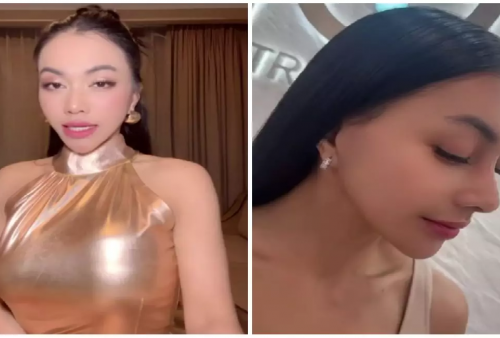 6 Artis Indonesia yang Terbuka Akui Operasi Payudara: Denada Artis Terbaru