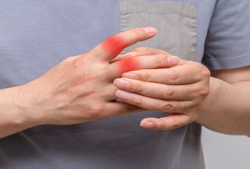 Cuma Butuh 5 Menit di Pagi Hari! 5 Rutinitas Pagi Ampuh untuk Mengendalikan Asam Urat Secara Alami, Wajib Dicoba Setiap Hari!